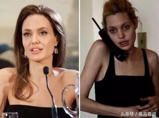 吸毒前后的变化对比,吸毒真的会毁容吗