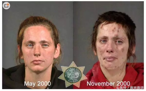 吸毒前后的变化对比,吸毒真的会毁容吗