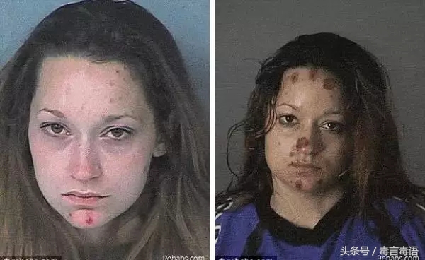 吸毒前后的变化对比,吸毒真的会毁容吗