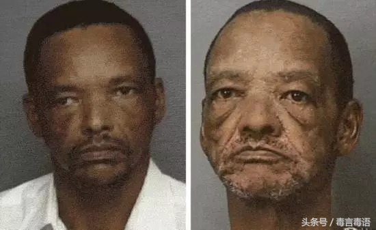 吸毒前后的变化对比,吸毒真的会毁容吗