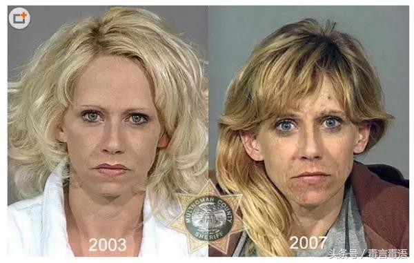 吸毒前后的变化对比,吸毒真的会毁容吗