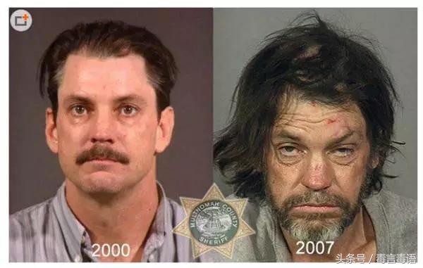 吸毒前后的变化对比,吸毒真的会毁容吗