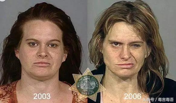 吸毒前后的变化对比,吸毒真的会毁容吗