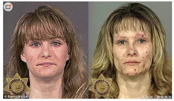 吸毒前后的变化对比,吸毒真的会毁容吗