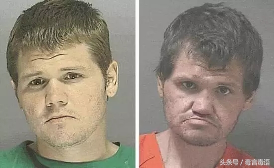 吸毒前后的变化对比,吸毒真的会毁容吗