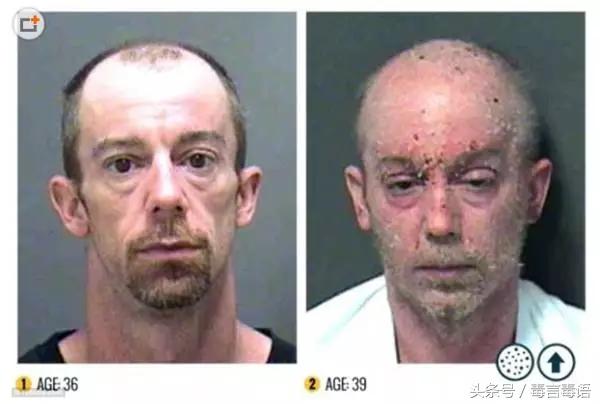 吸毒前后的变化对比,吸毒真的会毁容吗