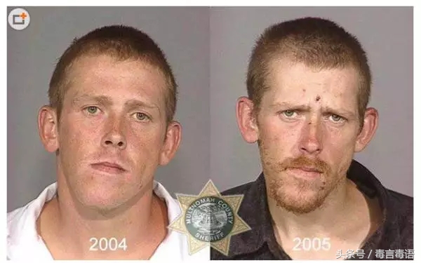 吸毒前后的变化对比,吸毒真的会毁容吗