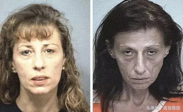 吸毒前后的变化对比,吸毒真的会毁容吗