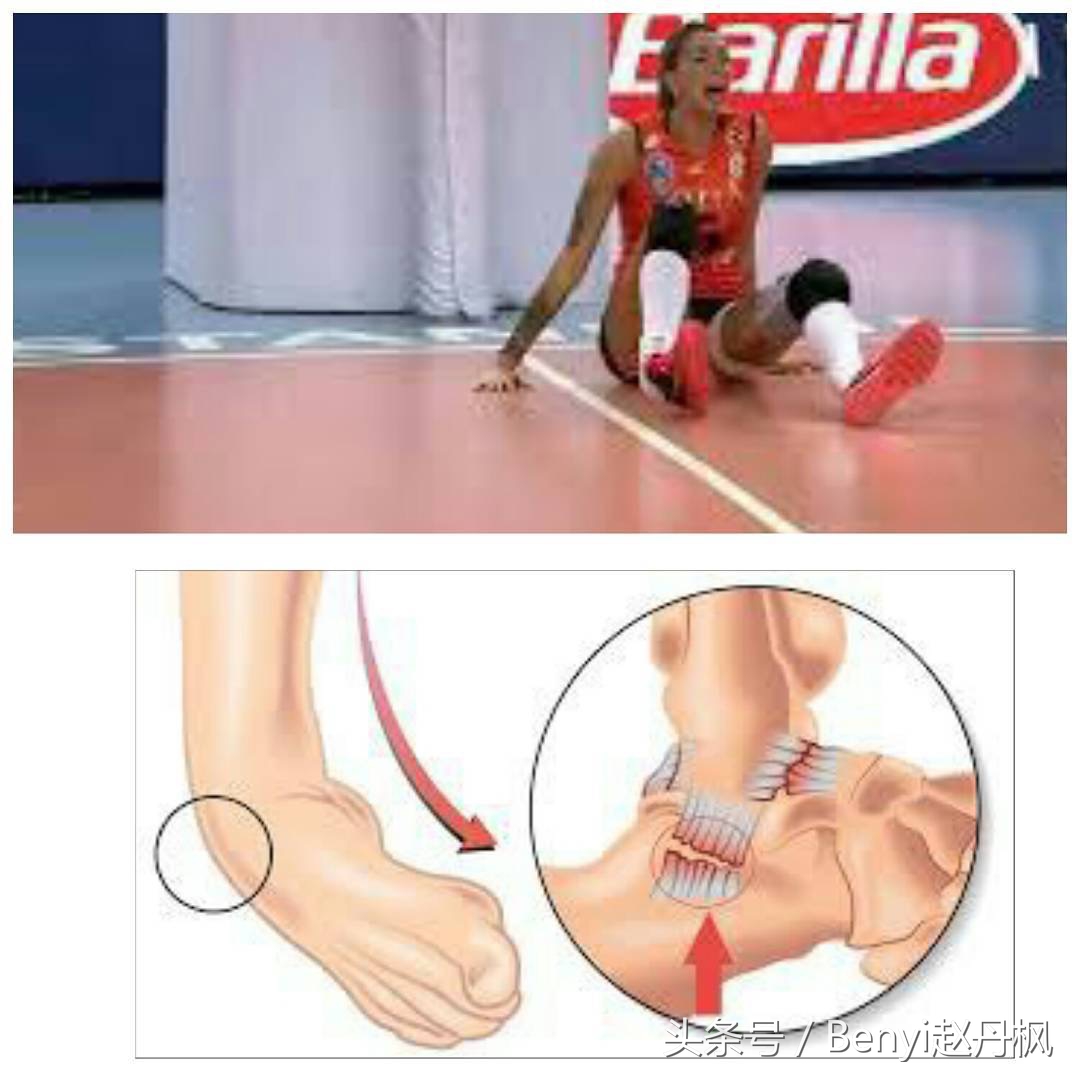 脚踝伤病的六个问题,脚踝受伤康复训练篮球