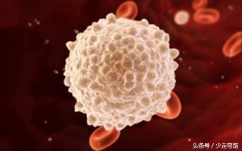 急性淋巴细胞白血病定义,小儿急性淋巴细胞性白血病