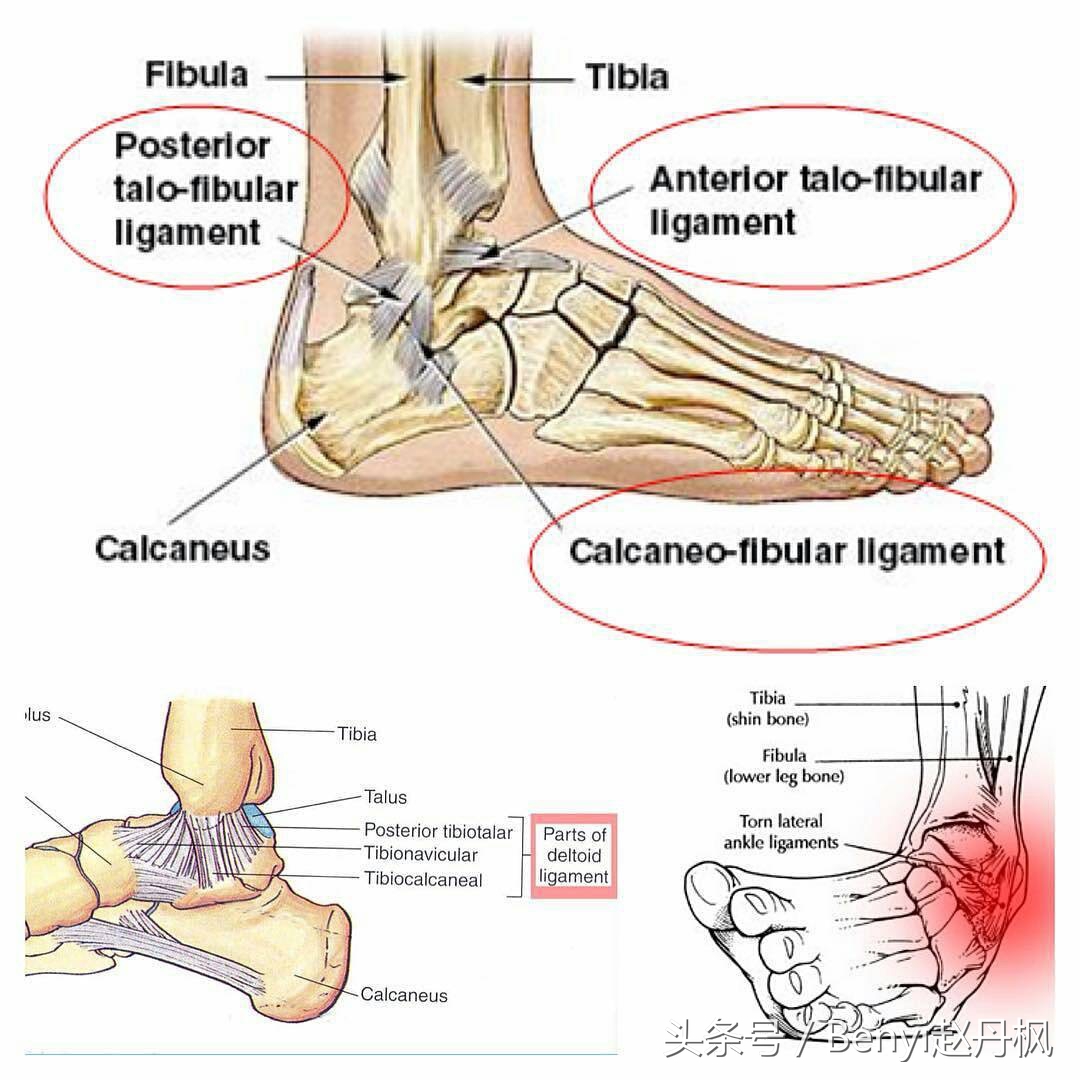 脚踝伤病的六个问题,脚踝受伤康复训练篮球