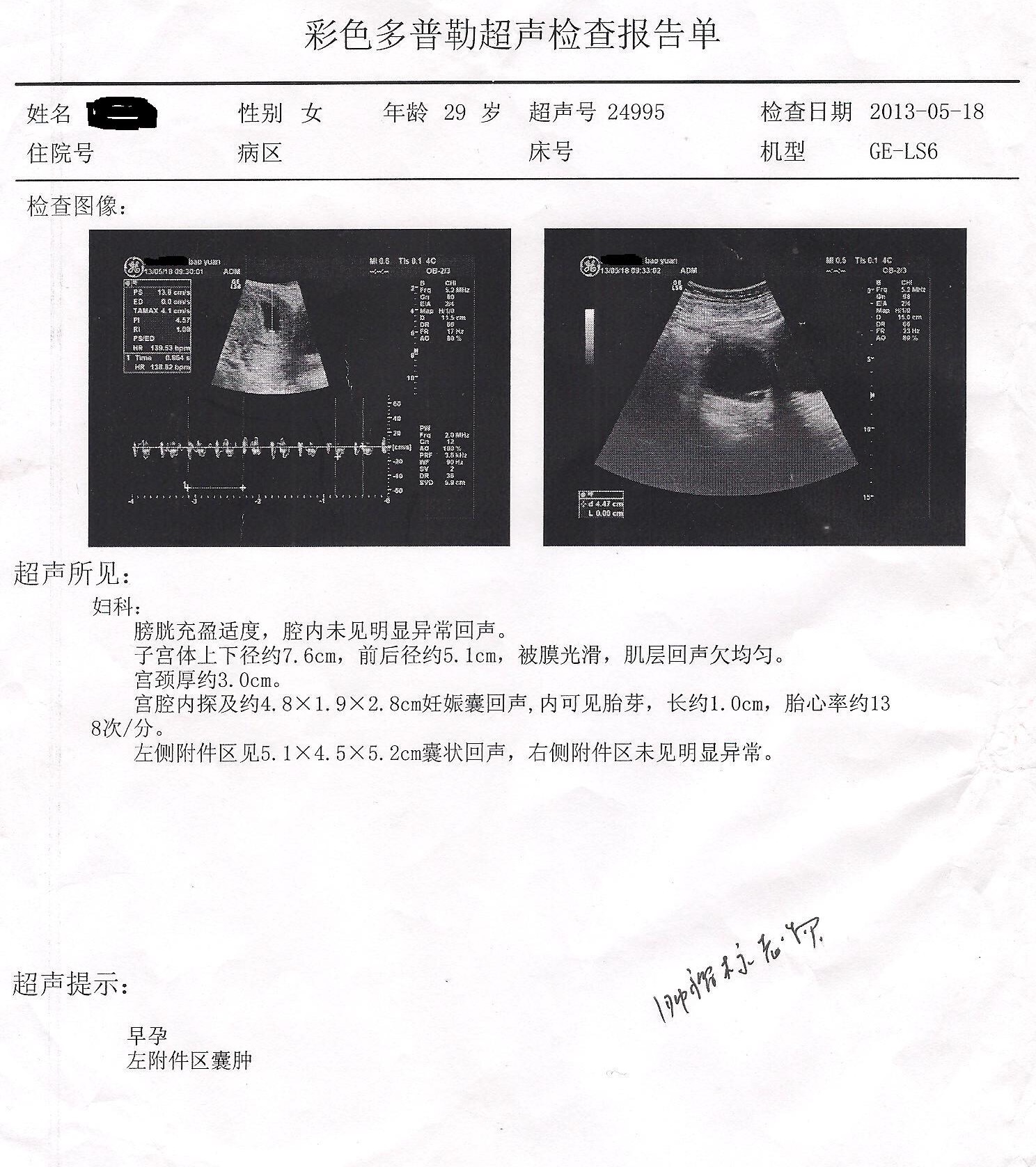 b超检查妈妈可以看屏幕吗,教你看b超单免去不必要的担心