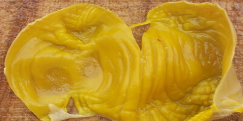 蒸熟的鸡内金有什么功效,家里杀鸡的鸡内金如何给小孩使用