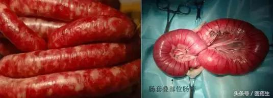 舌尖上的中医药论文,舌尖上的医疗