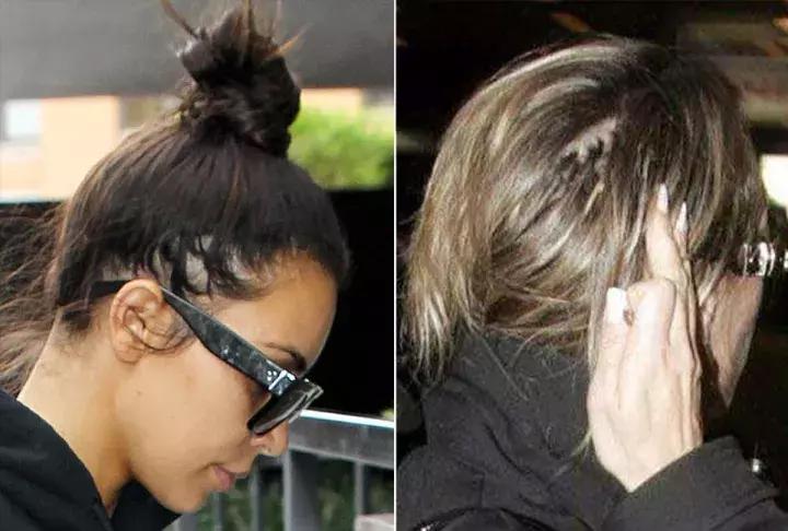 关于脱发你需要知道这10个真相,关于脱发你必须知道的真相