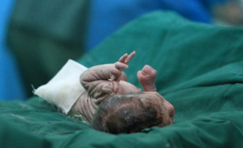 为什么顺产还要挨一刀，听听这些过来妈咪谈感受！