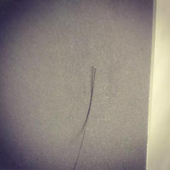 关于脱发你需要知道这10个真相,关于脱发你必须知道的真相