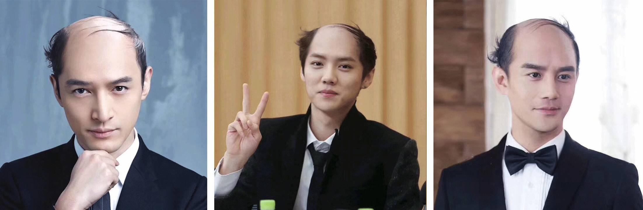 美颜相机都遮不住皱纹了,美颜相机美颜总掉怎么回事