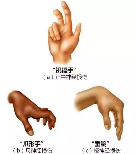 绘制神经系统的生理解剖图,人体骨骼血管神经系统解剖图