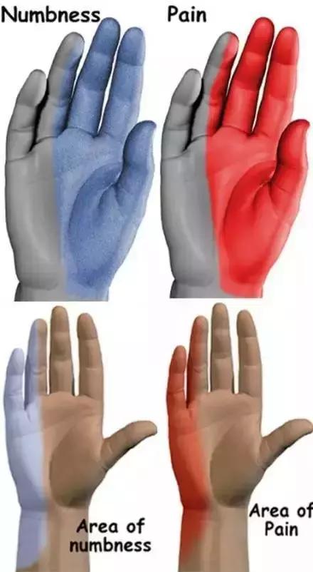 绘制神经系统的生理解剖图,人体骨骼血管神经系统解剖图