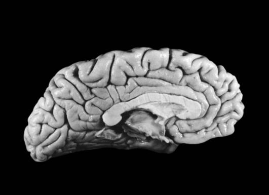 爱因斯坦大脑与众不同的奥秘所在,爱因斯坦大脑为什么比较聪明