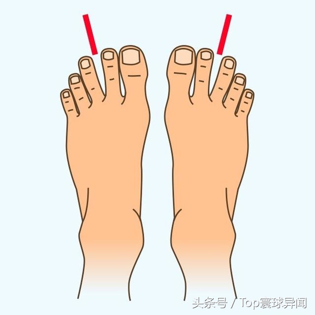 脚趾的长相说法,通过脚趾的形状看祖上的血统