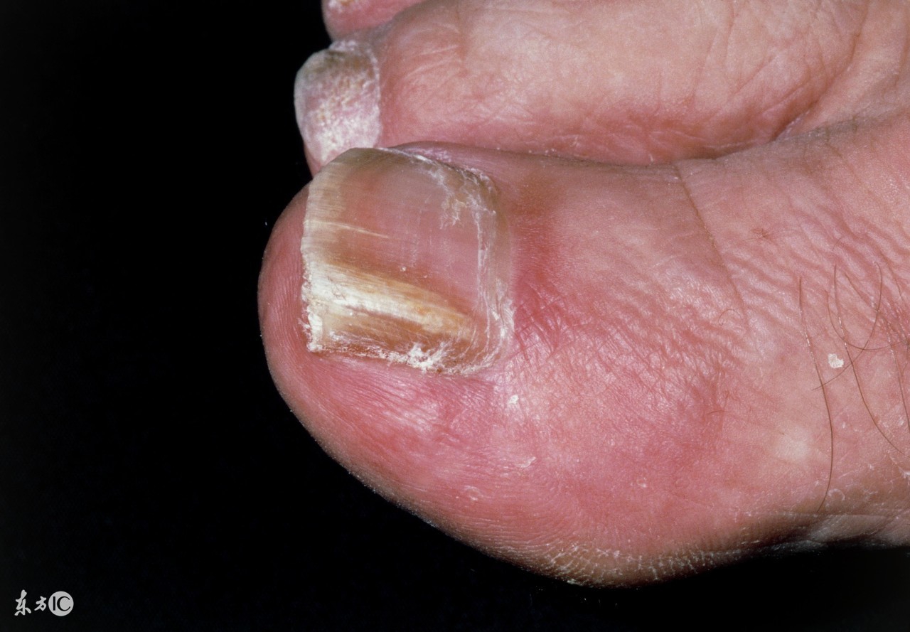 卫生巾最好不要用超过几个小时,使用卫生巾的这些误区