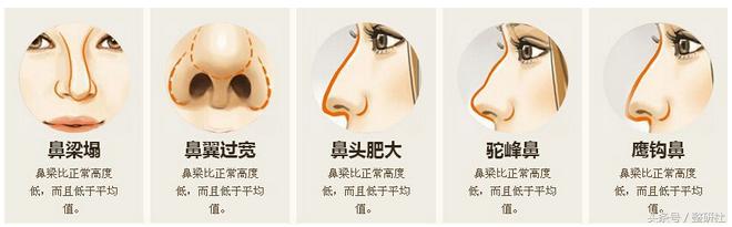 甜美少女养成计——俊翘美鼻