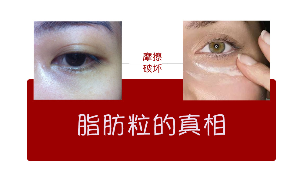 鱼子酱淡化泪沟眼袋黑眼圈眼霜,淡化黑眼圈眼袋泪沟哪个眼霜好