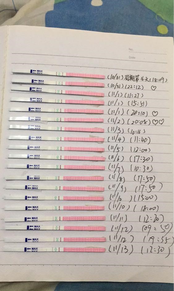 有巧克力囊肿就有子宫内膜异位症,子宫内膜异位症巧克力囊肿致不孕