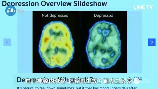 小鲜肉演技烂能超越经典前辈吗,怎样评价一些小鲜肉的演技