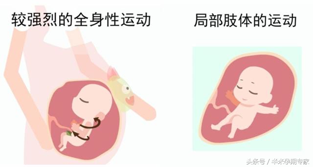 胎动是一种怎样的感觉,胎动晚上活跃怎么回事