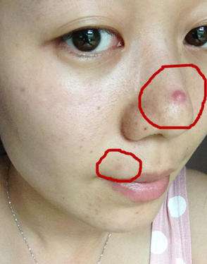 女人外面长什么痘，里面就有什么病！你造吗？