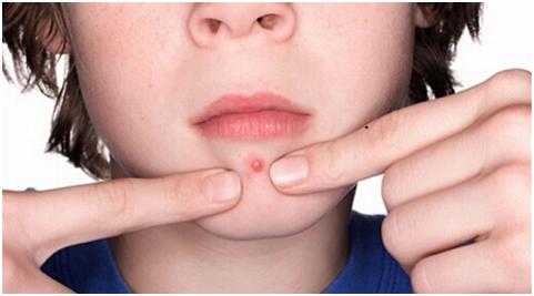 女人外面长什么痘，里面就有什么病！你造吗？