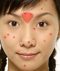 女人外面长什么痘，里面就有什么病！你造吗？