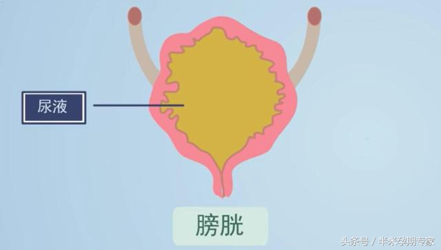 产后尿潴留怎么治,产后尿潴留怎么读