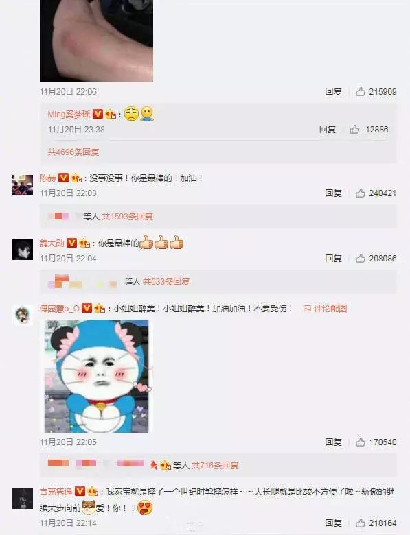 奚梦瑶摔跤对他导致的影响有多大,奚梦瑶维密大秀摔跤