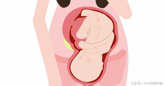 胎位不正婆婆让顺产,胎位不正还能顺产么动画演示