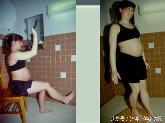 孕期耻骨痛怎么训练恢复,孕期耻骨疼怎么锻炼