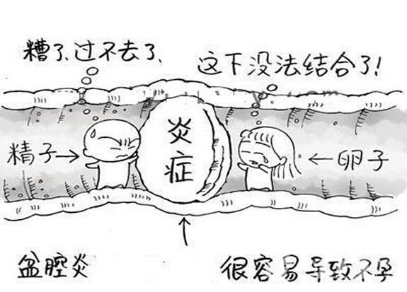 听说你是盆腔炎？很可能你被过度诊断和治疗