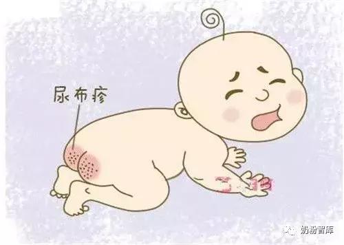 宝宝红屁股到底怎么预防,夏季如何预防宝宝红屁股