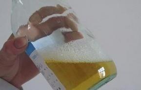 24小时尿蛋白定量留尿注意事项,24小时尿蛋白定量前注意事项