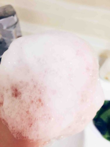 产后大把掉头发是什么原因引起的,产后头发剪短可以缓解掉头发吗