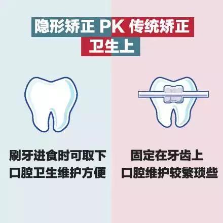 美丽刻隐形矫正怎么样,隐形矫正牙齿视频教程