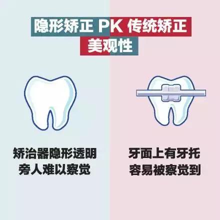美丽刻隐形矫正怎么样,隐形矫正牙齿视频教程