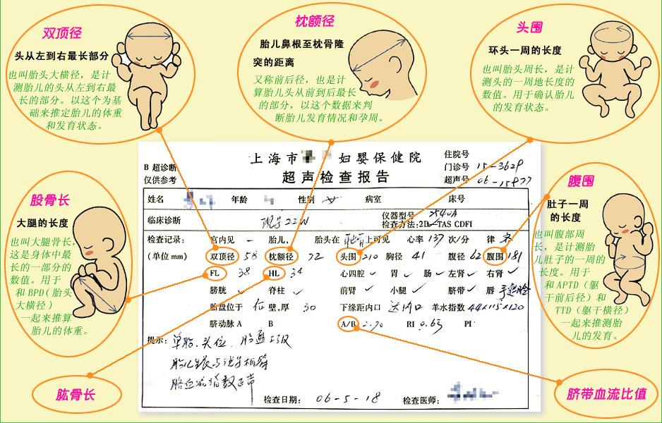如何看懂妇科b超单,宫腔可见混合性回声是什么意思