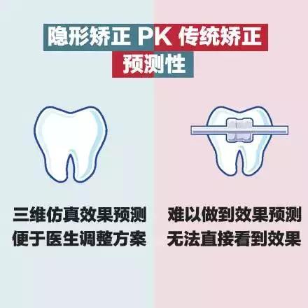 美丽刻隐形矫正怎么样,隐形矫正牙齿视频教程