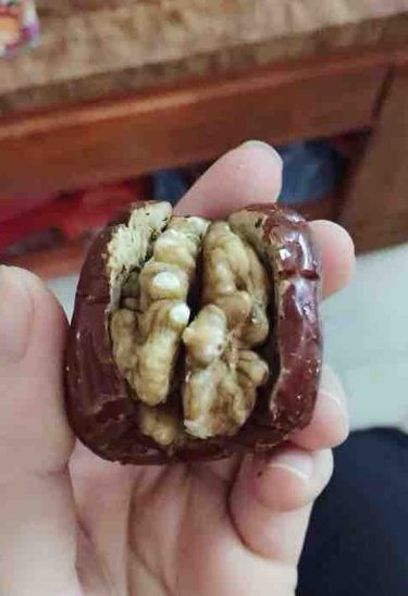 产后大把掉头发是什么原因引起的,产后头发剪短可以缓解掉头发吗