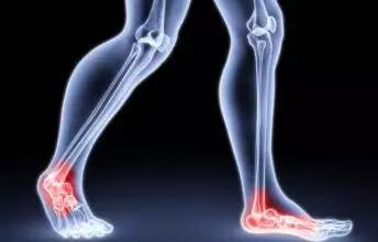 脚踝扭伤怎么办怎样按摩,脚踝扭伤怎么办幼儿园