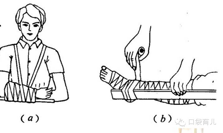 收❗宝宝外伤护理！很全面！专业医生讲述！不怕一万，就怕万一，收下来备用！